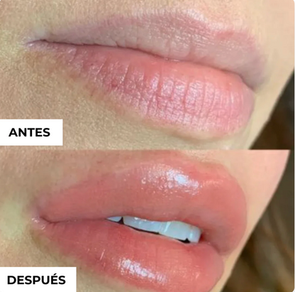 Voluminizador de Labios inoovagoods